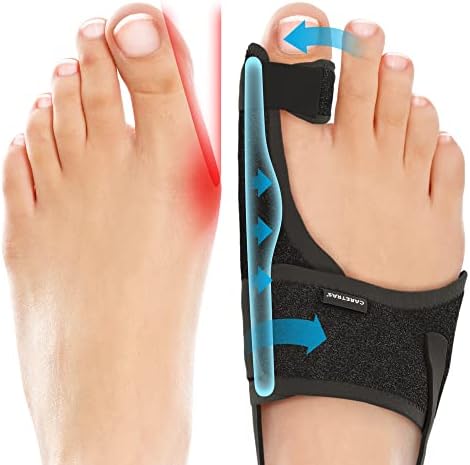 Caretras Bunion Corrector, Orthopedic Bunion Splint, Big Toe Separator Pain