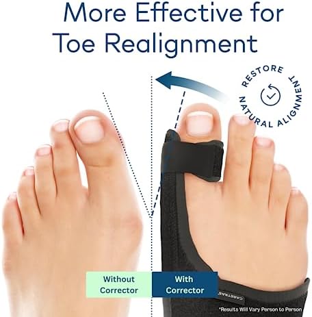 Caretras Bunion Corrector, Orthopedic Bunion Splint, Big Toe Separator Pain 2